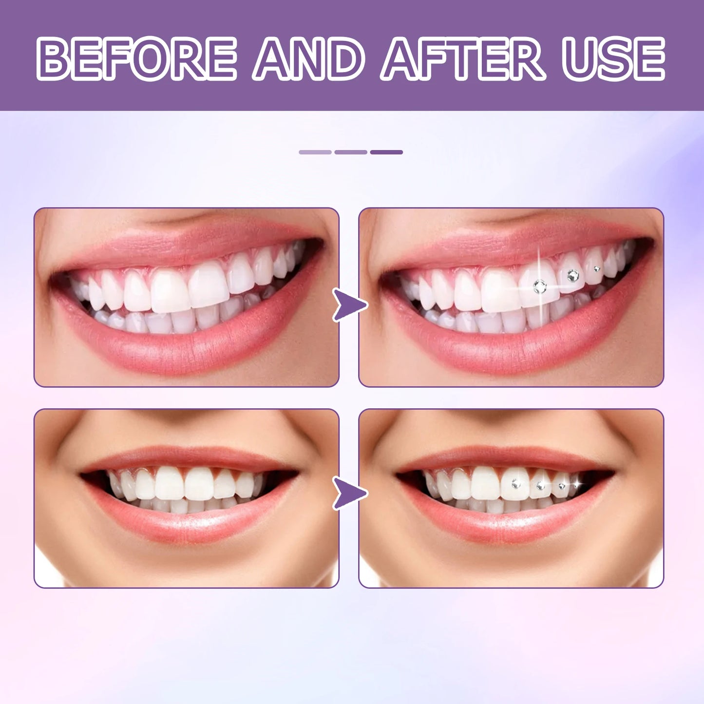 Tooth Gem Glue Dental Adhesive for Tooth Gems Diamond Kit Glue Teeth Crystal Jewelry Sturdy Tooth Jewelry Orthodontic Gel