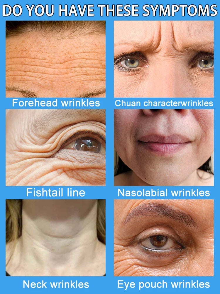 Wrinkles disappear Become beautiful now