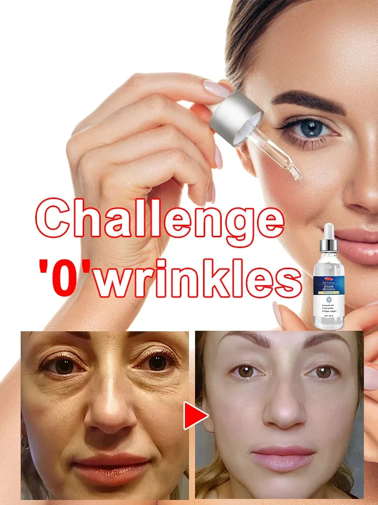Wrinkles disappear Become beautiful now