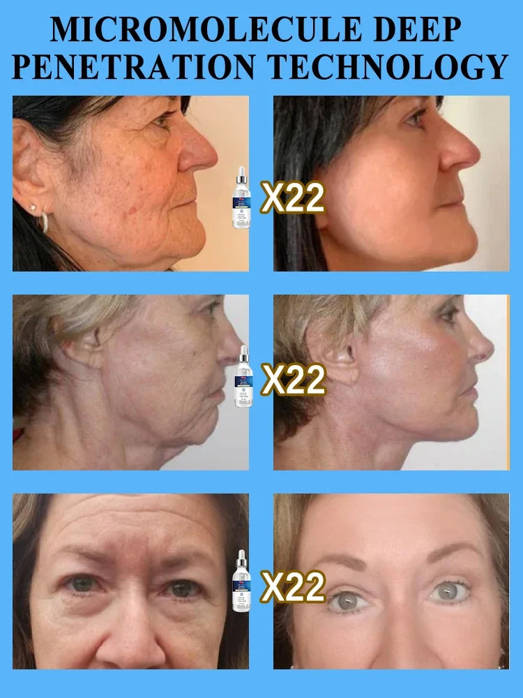 Wrinkles disappear Become beautiful now